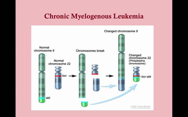 CML Leukimia.jpg