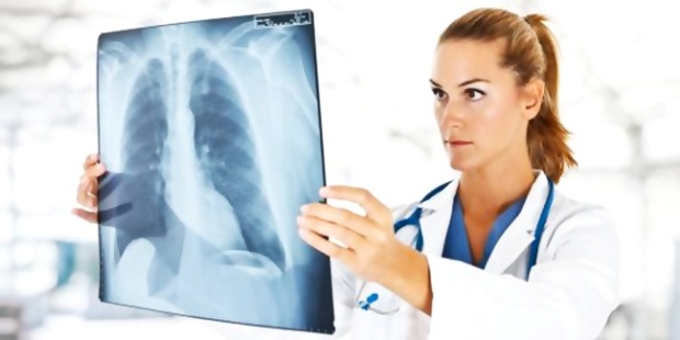 Diagnosis-kanker-paru-paru