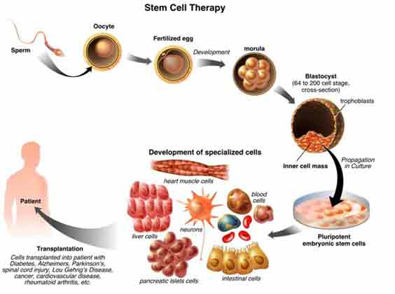 stem-cell1
